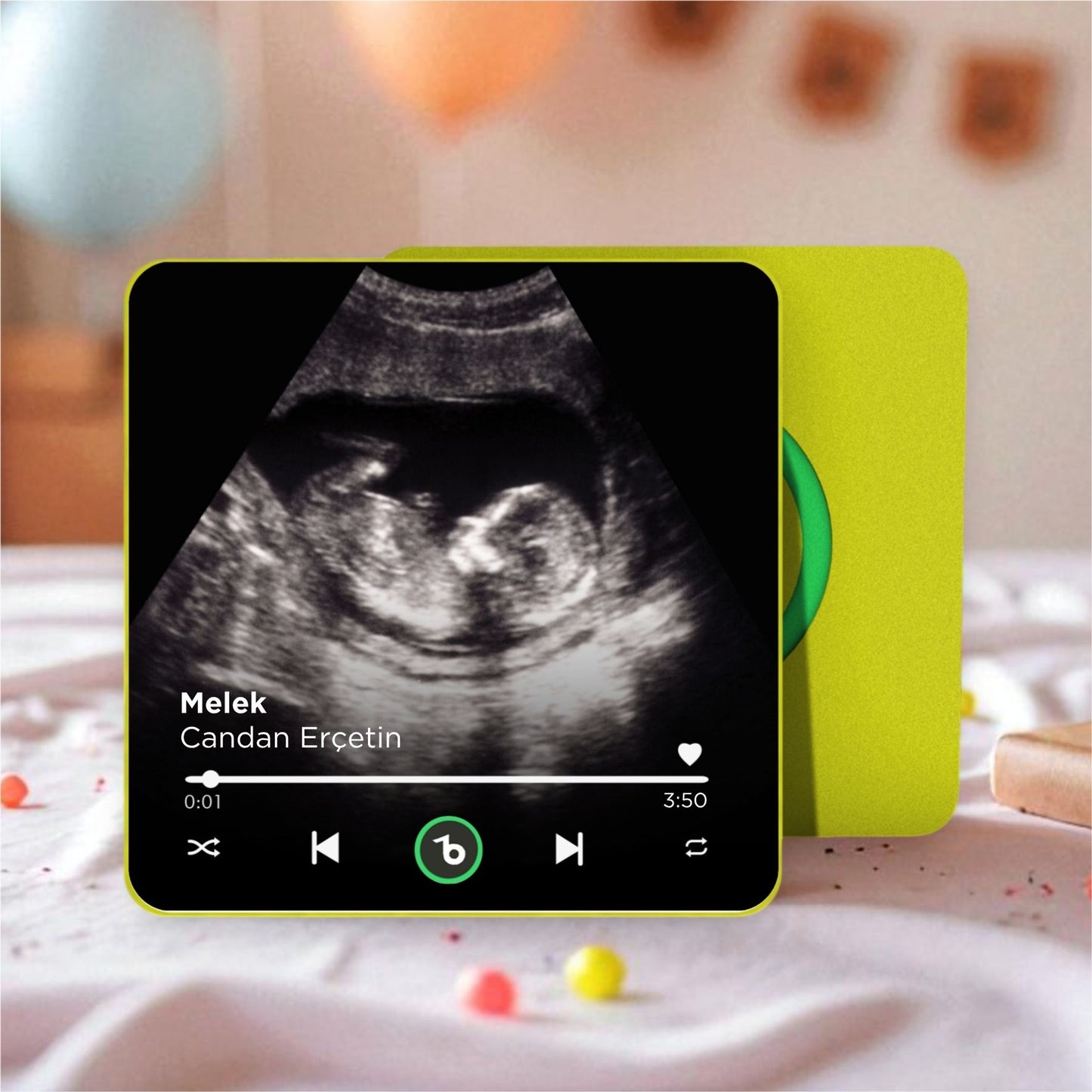 Ultrason Fotoğraflı DizzyMagnet Kişiye Özel Ses ve Müzikli Magnet V4.0