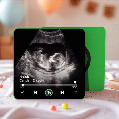 Ultrason Fotoğraflı DizzyMagnet Kişiye Özel Ses ve Müzikli Magnet V4.0